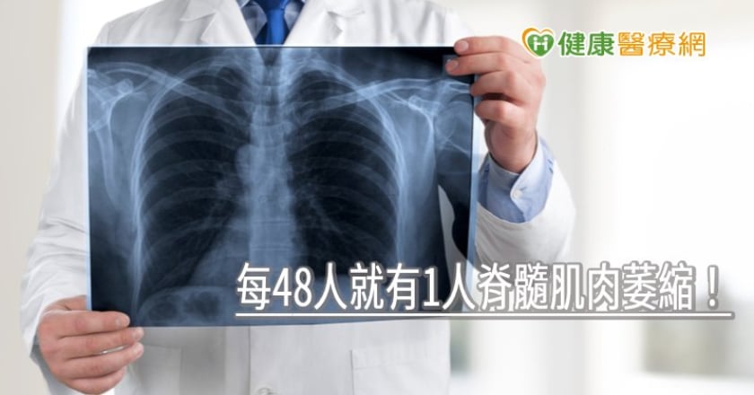 每48人就有1人脊髓肌肉萎縮！　「脊柱側彎矯正手術」新希望