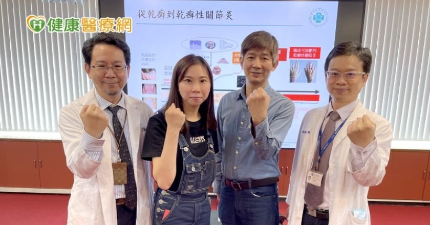 不到一年乾癬變乾癬關節炎 中榮共同照護提升生活品質