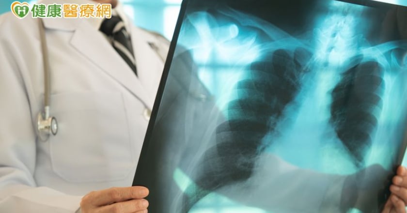 沒抽菸卻得肺癌？醫親解真相：基因突變和環境因素是關鍵！