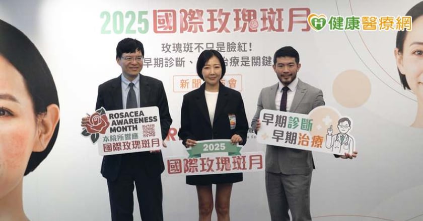 知名藝人罹「玫瑰斑」 擦1物後嚴重惡化!醫籲「正確治療」阻損傷加劇