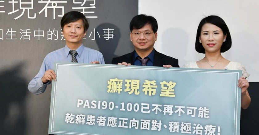 這病逾半數從頭開始　頭皮屑掉滿地莫輕忽