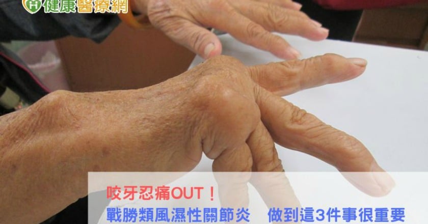 咬牙忍痛OUT！　戰勝類風濕性關節炎　做到這3件事很重要