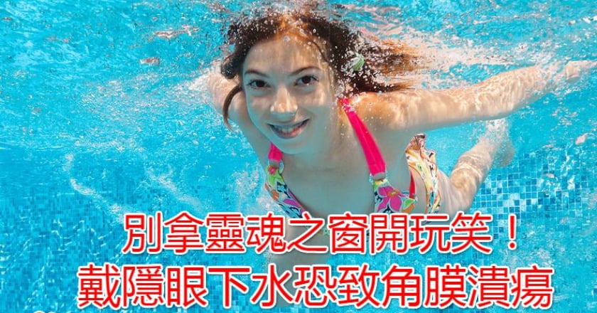 別拿靈魂之窗開玩笑! 戴隱眼下水恐致角膜潰瘍