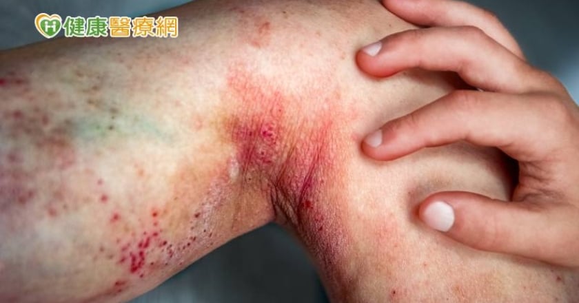 健保擴增給付9新藥！ 兒童、癌症、罕病給付範圍一次看