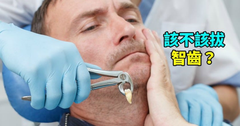 該不該拔智齒？　醫：這些情況拔除較妥