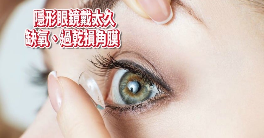 隱形眼鏡戴太久 上班族角膜受損嚴重散光!