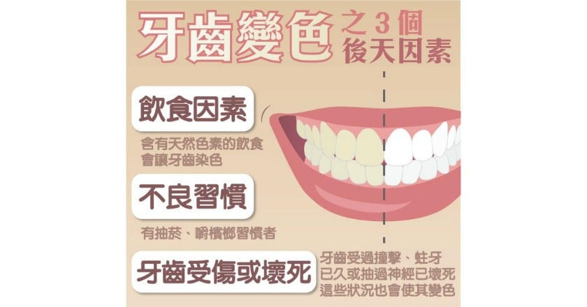 年紀大牙齒就變色？　牙醫揭密３大原因
