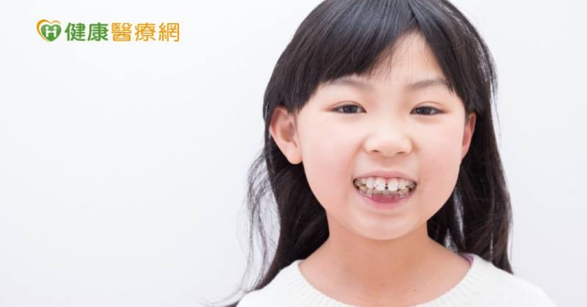兒童口腔保健|牙齒立正站好! 掌握矯正時機&維持重點免砍掉重練
