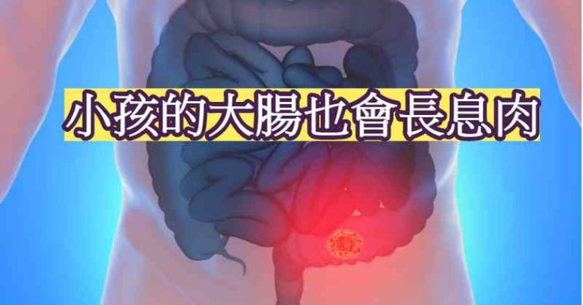 大號老帶血! 小孩也會長大腸息肉