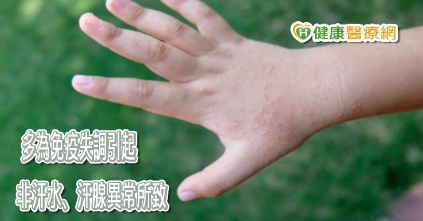 汗皰疹為什麼這麼癢？　夏日調理減少發作頻率