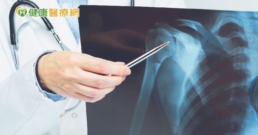 林志穎車禍粉碎性骨折　駕駛人要留意三種狀況