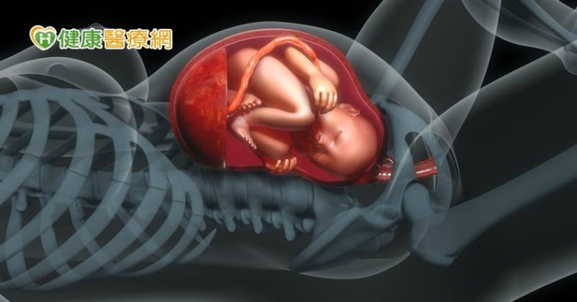 肚子裡的寶貝健康嗎？　高層次超音波從頭到腳都可檢查
