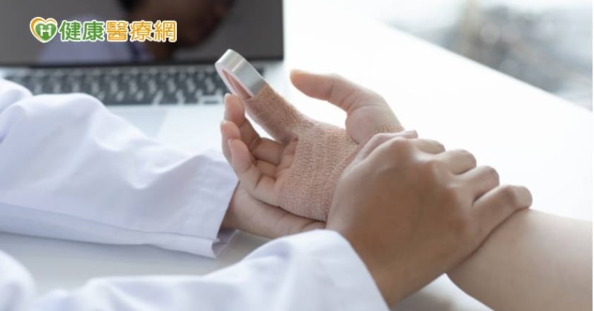 跌倒手指骨折難工作　「微型互鎖式骨板」兩周後已可活動