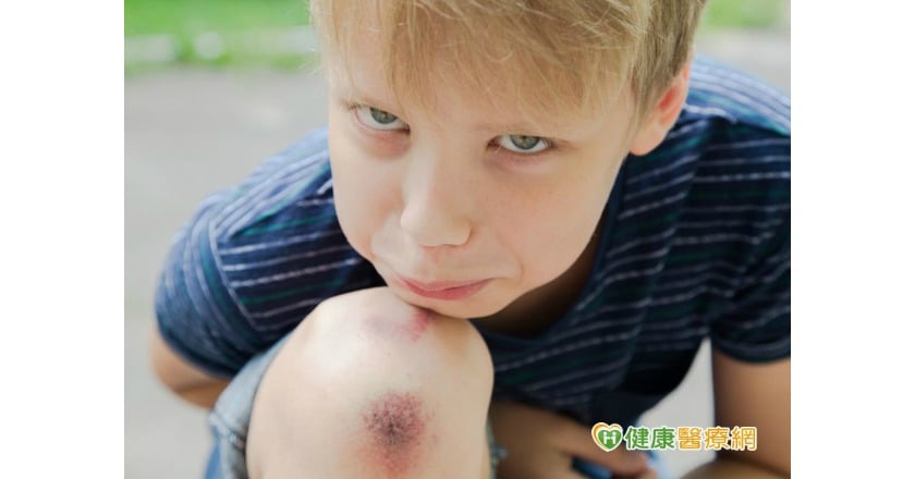 傷口照護不當　當心蜂窩性組織炎要你命