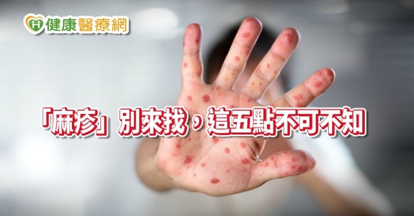 麻疹疫情全球爆發! 避免「麻」煩,這五點不可不知