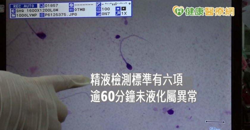 精蟲液化時間過長難懷孕？　中醫治療4個月如願當爸媽
