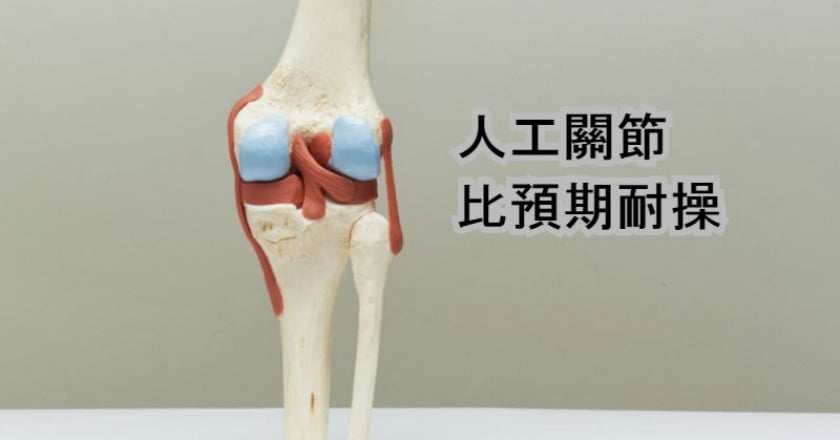 人工關節比預期耐用 醫:助判手術時機