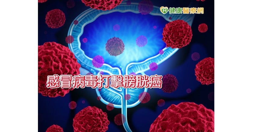 常見感冒病毒立功　小型研究：打擊膀胱癌