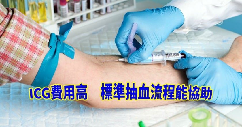 切肝打一針ICG還不夠 新採血標準更精準