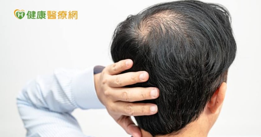 全台360萬落髮患者新福音!國際新型AMT自體微移植技術挽救毛髮健康