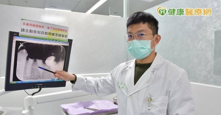齲齒殘根不治療　重者恐引致命感染