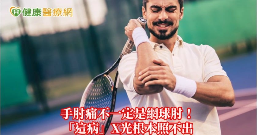 手肘痛不一定是網球肘！　「這病」X光根本照不出