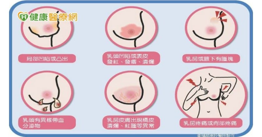 乳頭搔癢先檢查是不是內衣太髒! 出現4症狀快就醫