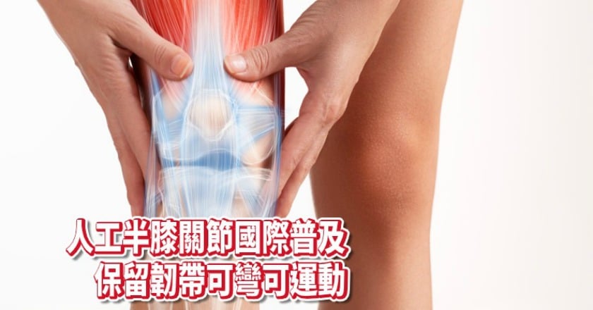 膝蓋痛吃藥、打針都無效 置換人工半膝關節「彎更多」