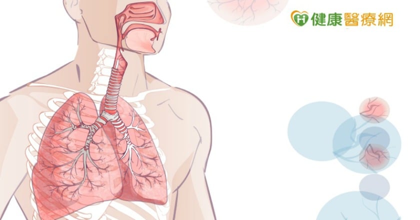 新冠肺炎輕症變重症　胸腔科醫師：呼吸道微環境很關鍵