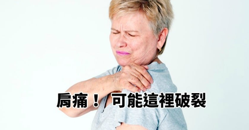肩痛不一定是五十肩！　可能是這裡破裂了