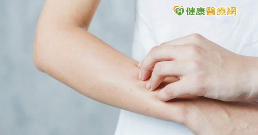 汗皰疹癢到抓狂　中醫師：抓了更癢會惡性循環