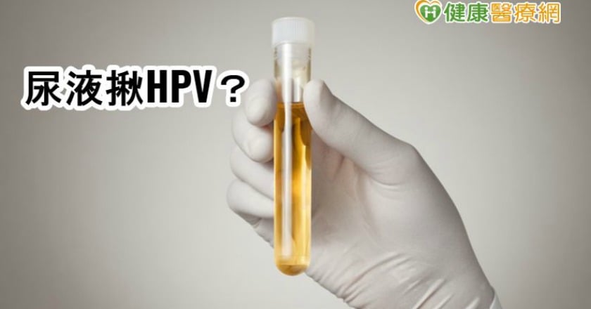 子宮頸抹片檢查太害羞？　英國測試尿檢潛力