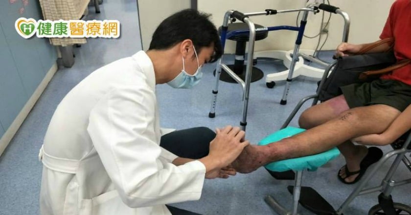 男子遇車禍險截肢　顯微血管皮瓣救回他的腳