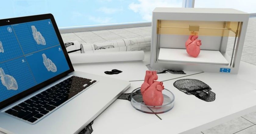 3D列印技術　降低心瓣膜手術風險