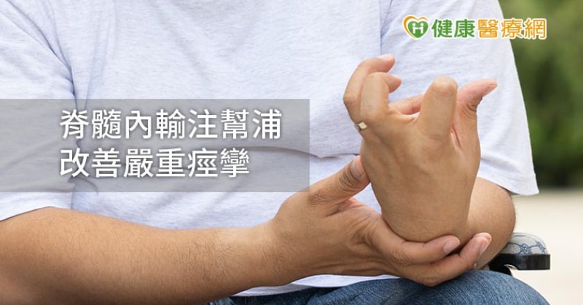 嚴重性痙攣致行動不便 「脊髓內輸注幫浦療法」助改善