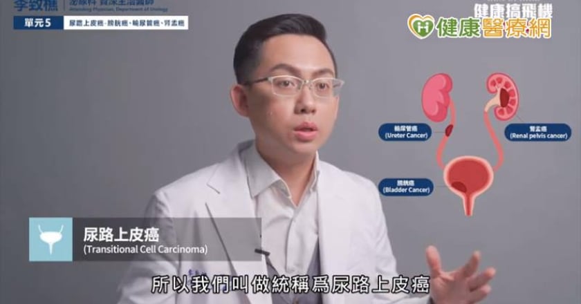 無痛血尿勿輕忽！中年男罹患尿路上皮癌