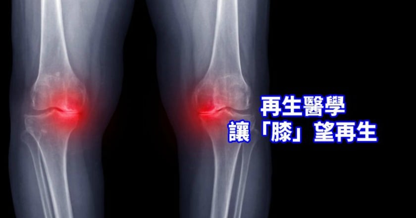 再生醫學中的黃金　重燃新「膝」望