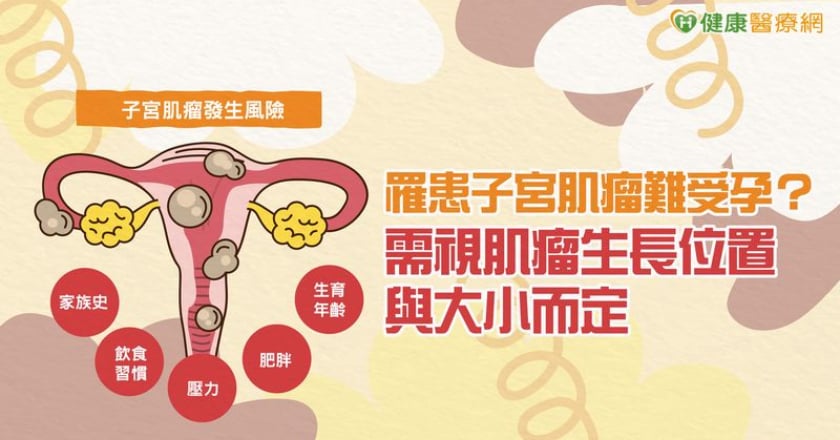 罹患子宮肌瘤難受孕？需視肌瘤生長位置與大小而定