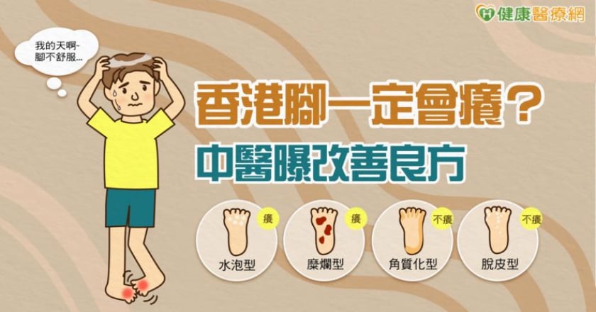 香港腳一定會癢？中醫曝改善良方