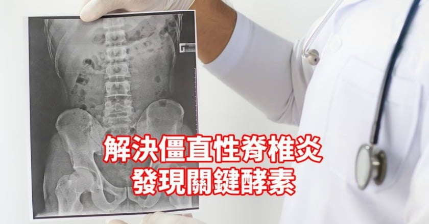 脊椎僵化如一根竹竿？　這項關鍵酵素是救星