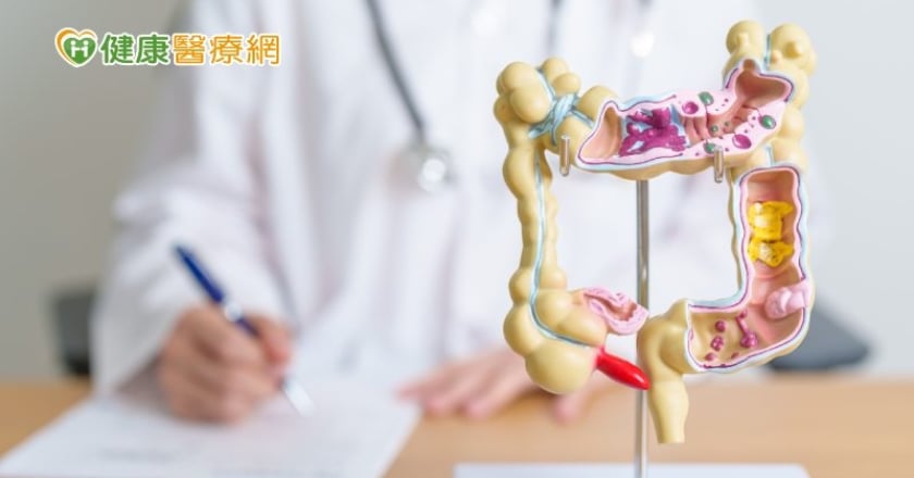 大腸癌篩檢陽性應再篩一次?二次篩檢陰性就沒事? 錯!「這樣做」才正確