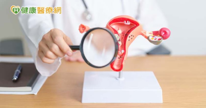 什麼是「子宮鏡手術」? 手術過程、手術風險、術後照顧一次看!
