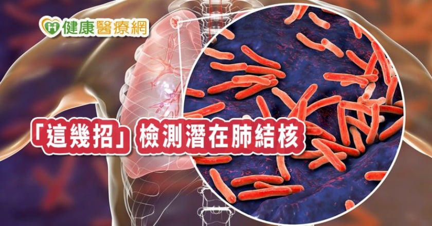咳嗽帶痰、胸痛? 七分篩檢法揪出「肺結核」