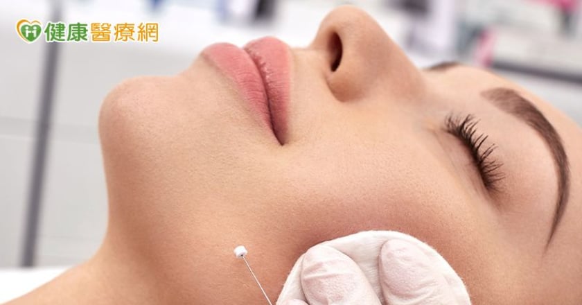 埋線拉提能逆齡？醫師揭線雕抗老真相