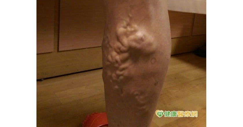 時間到了就換姿勢　不怕小蚯蚓爬滿腿