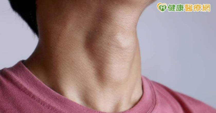女生也會有喉結?擔心是健康出問題?醫列伴隨「4症狀」要就醫檢查!