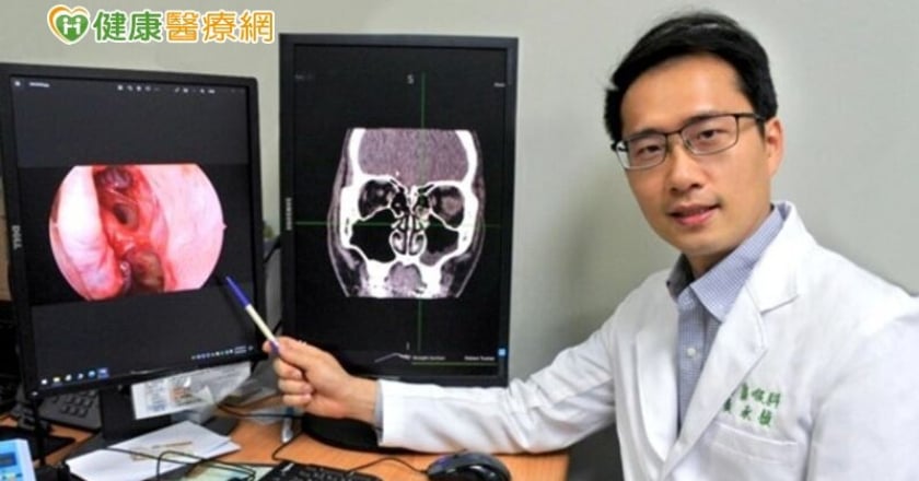 慢性鼻竇炎治療新科技 膠原蛋白基質粉輔助傷口癒合