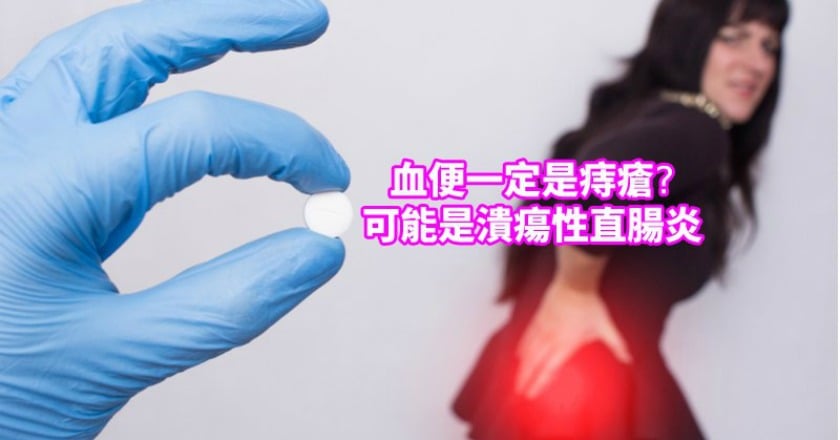 血便不一定是痔瘡　潰瘍性直腸炎也會引起