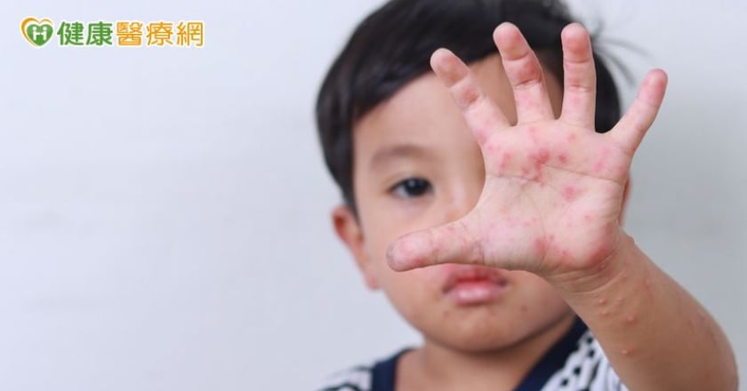 腸病毒也跟著開學！醫：A71型重症率高 家長務必留意7大重症前兆