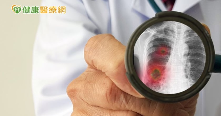 流感併發金黃色葡萄球菌肺炎，後果更嚴重….
